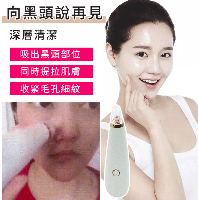 【蝶蓮娜家用吸黑頭神器】黑頭、粉刺、痘痘都不見了,深層清潔,收縮毛孔細紋!