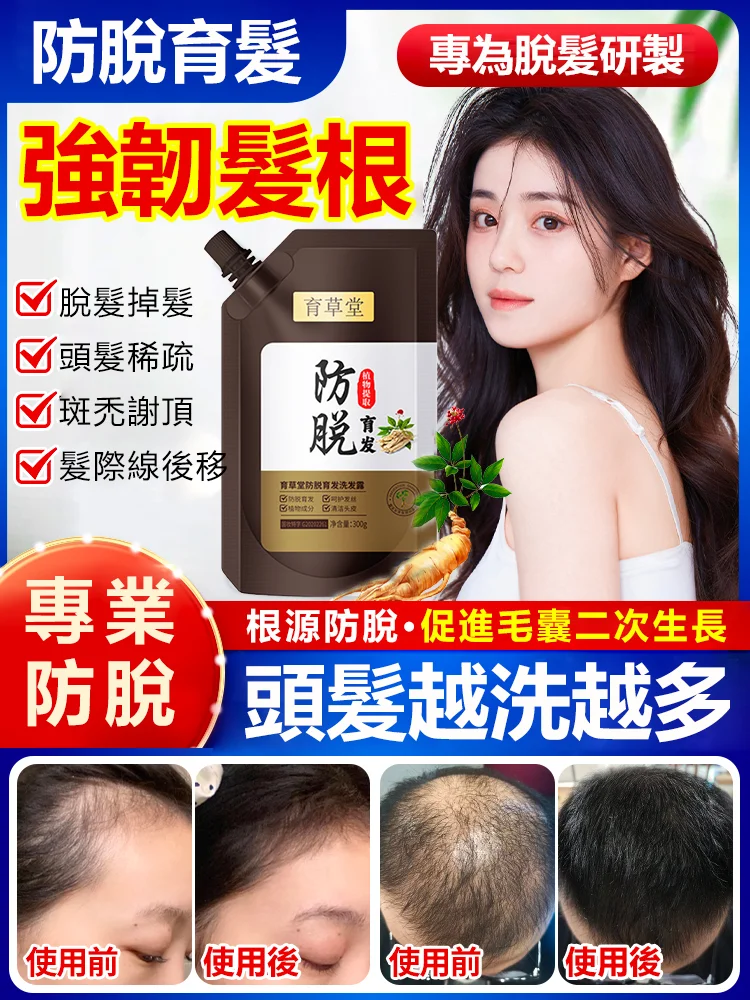 【育草堂防脫育髮液】防脫育發洗髮露,穩固髮根,柔順亮澤,強韌秀髮,育發護髮,防脫固髮!