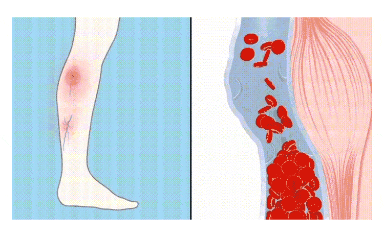 1703766064487686.png 8c337fa6efc9ac2f159a7c1e694e955.png